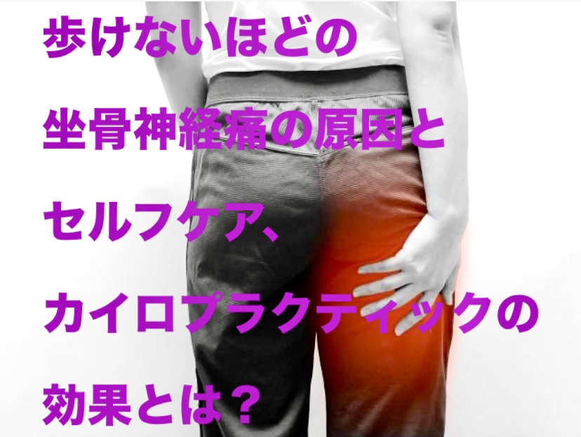 歩けないほどの坐骨神経痛の原因とセルフケア、カイロプラクティックの効果とは？