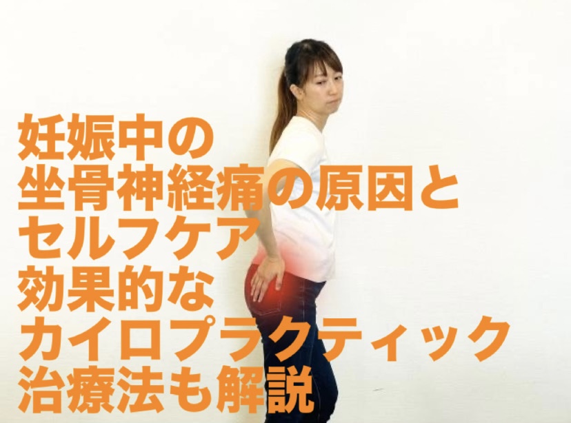 妊娠中の坐骨神経痛の原因とセルフケア｜効果的なカイロプラクティック治療法も解説