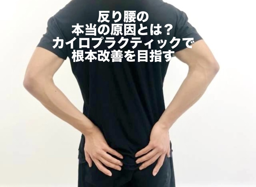反り腰の本当の原因とは?カイロプラクティックで根本改善を目指す