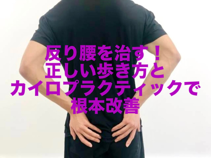 反り腰を治す!正しい歩き方とカイロプラクティックで根本改善